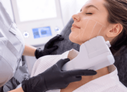HIFU Behandlung in Wien